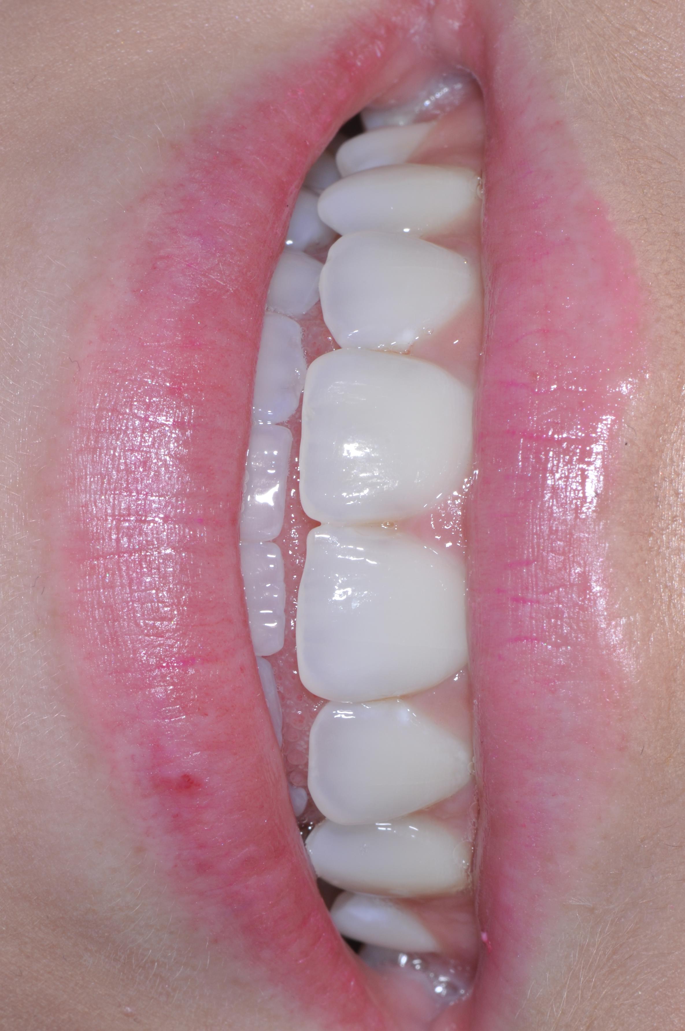 Dental Blog Glendale AZ Dentist Dr. Lee Ann Brady