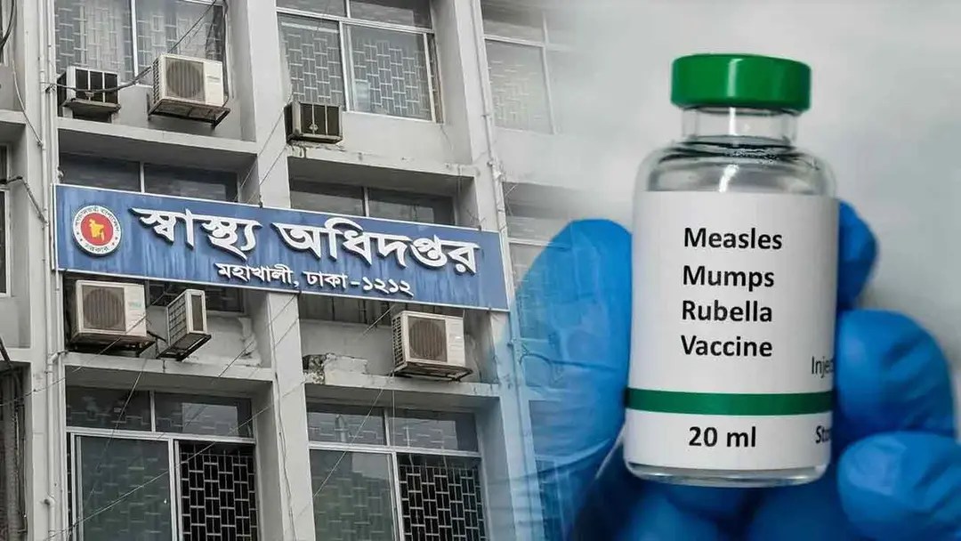 হামে গত ২৪ ঘণ্টায় ১৭ শিশুর মৃত্যু এবং দেড় মাসে প্রাণহানি ৩১১