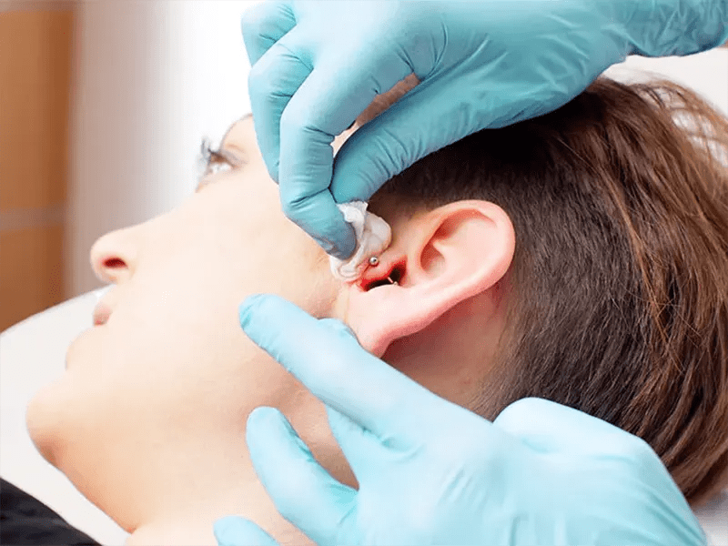 How to Shrink an Ear Piercing Hole Surgical + Natural Solutions