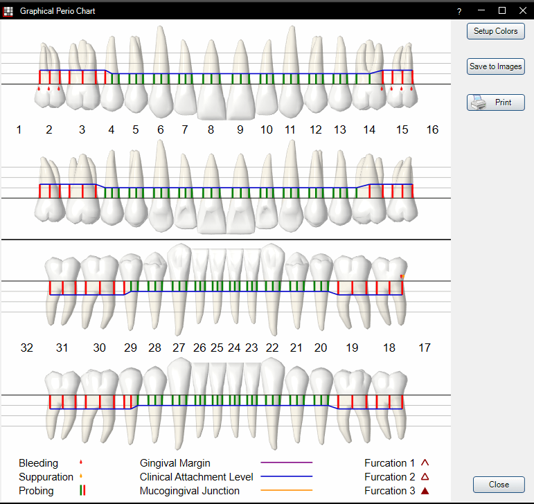 Perio Chart