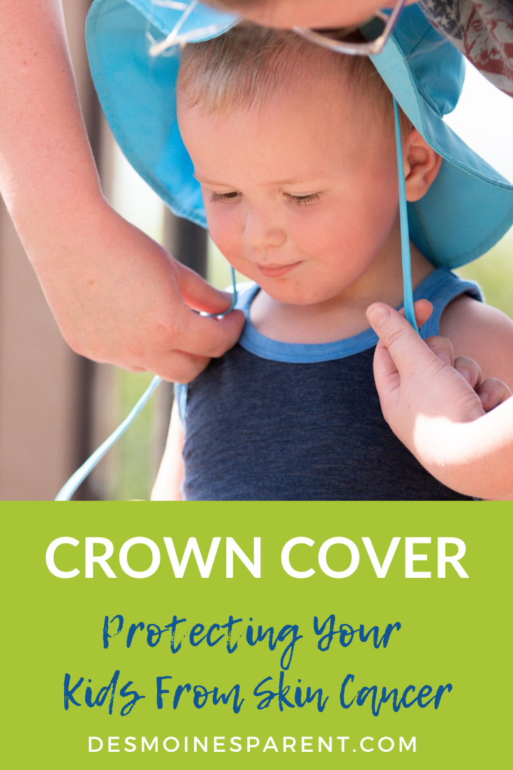 Can Infants Get Skin Cancer / Skin Cancer In Young Kids Babycenter