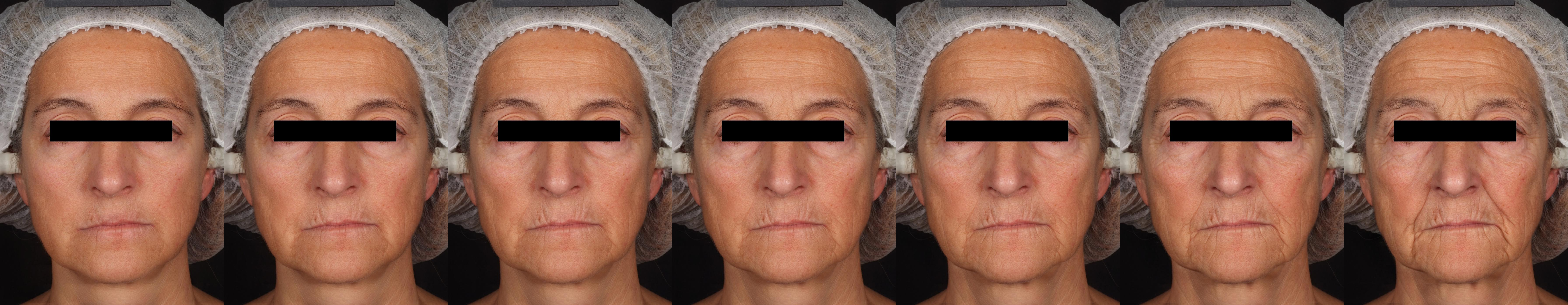 AgingMapGAN (AMGAN) HighResolution Controllable Face Aging with