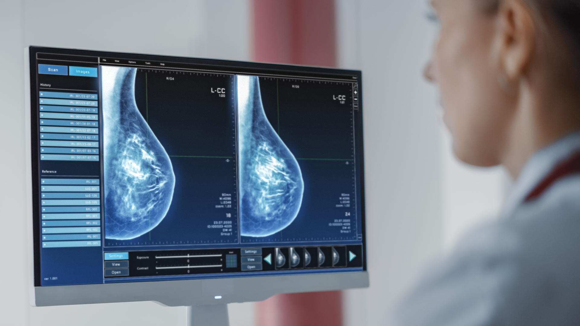 New AI Breast Cancer Model is the First to Show Diagnostic Process NVIDIA Technical Blog