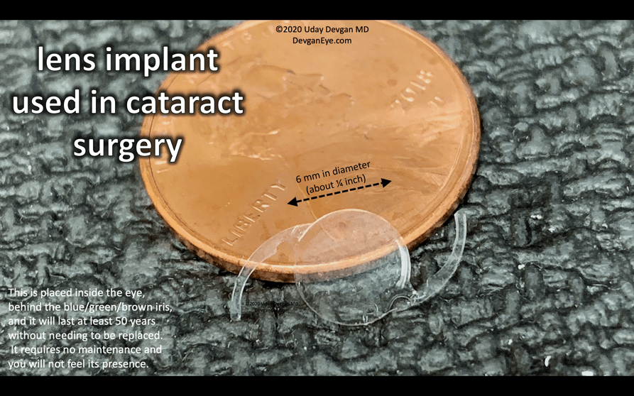 Lens Implant Options by DevganEye Surgery