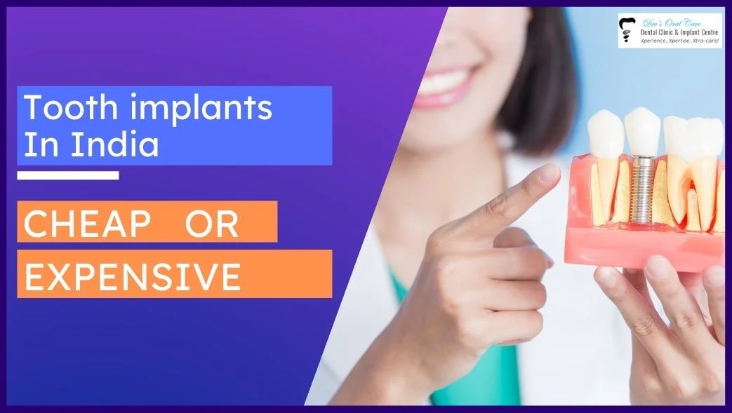 Tooth implants In India cheap or expensive? Dev's Oral Care