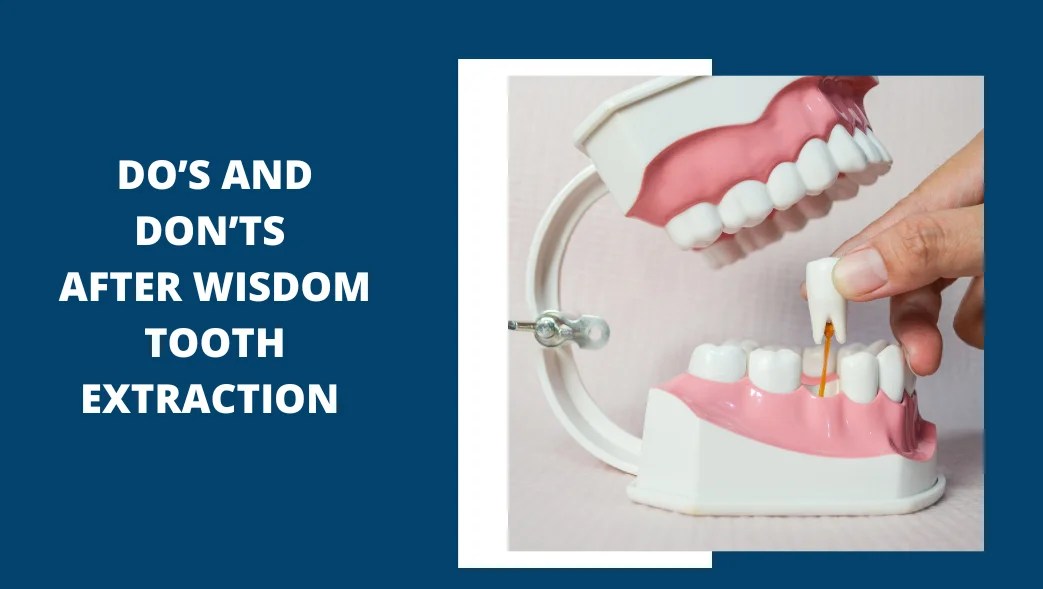 Do’s and don’ts after wisdom tooth extraction