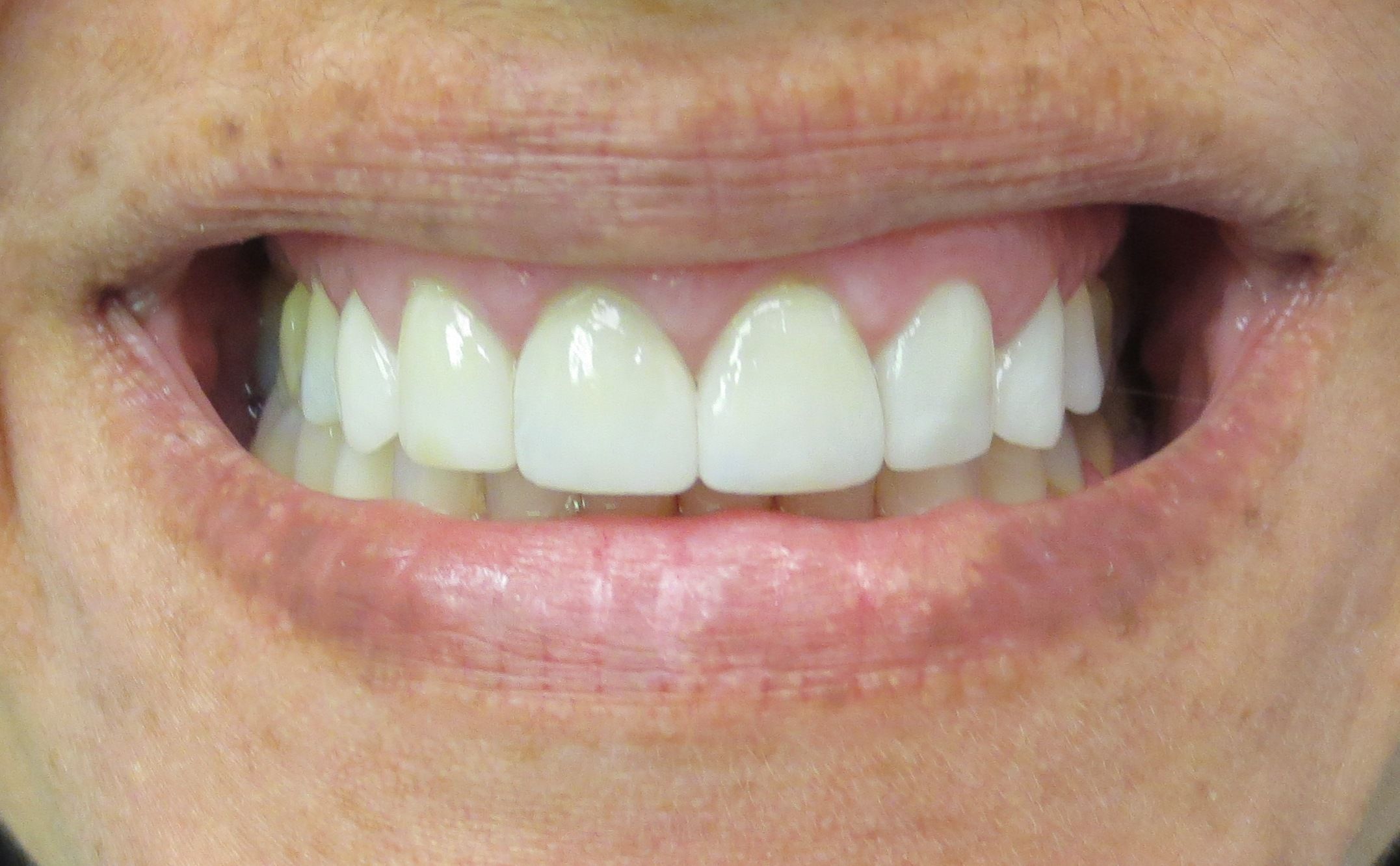 Testimonials and Photos Family Dental DL Family Dental