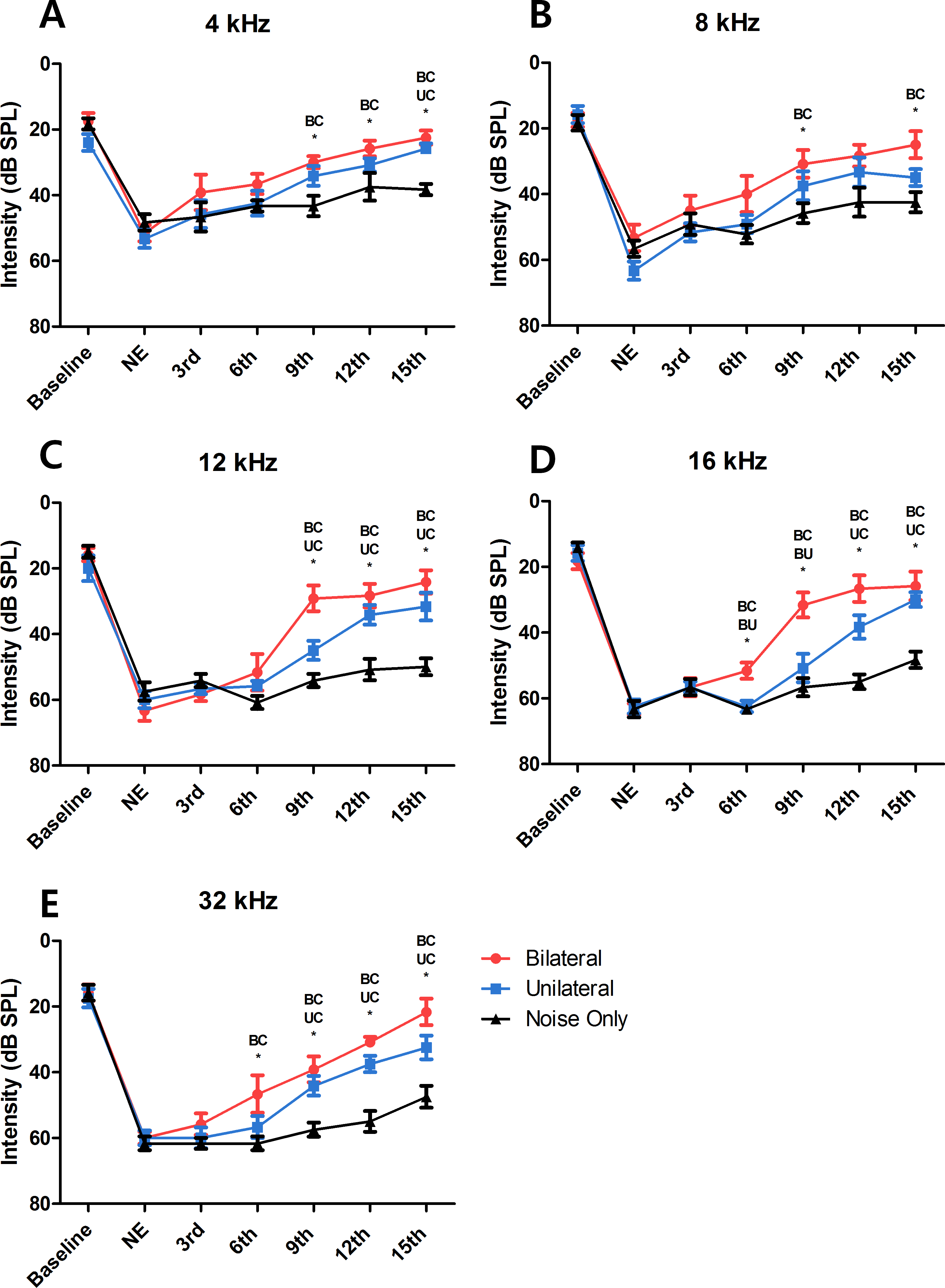 Simultaneous bilateral laser therapy accelerates recovery after noise