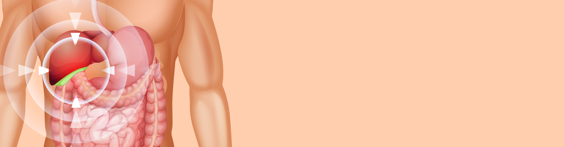 Causes Of Gallbladder Polyps in Indians Symptoms and Treatment MFine