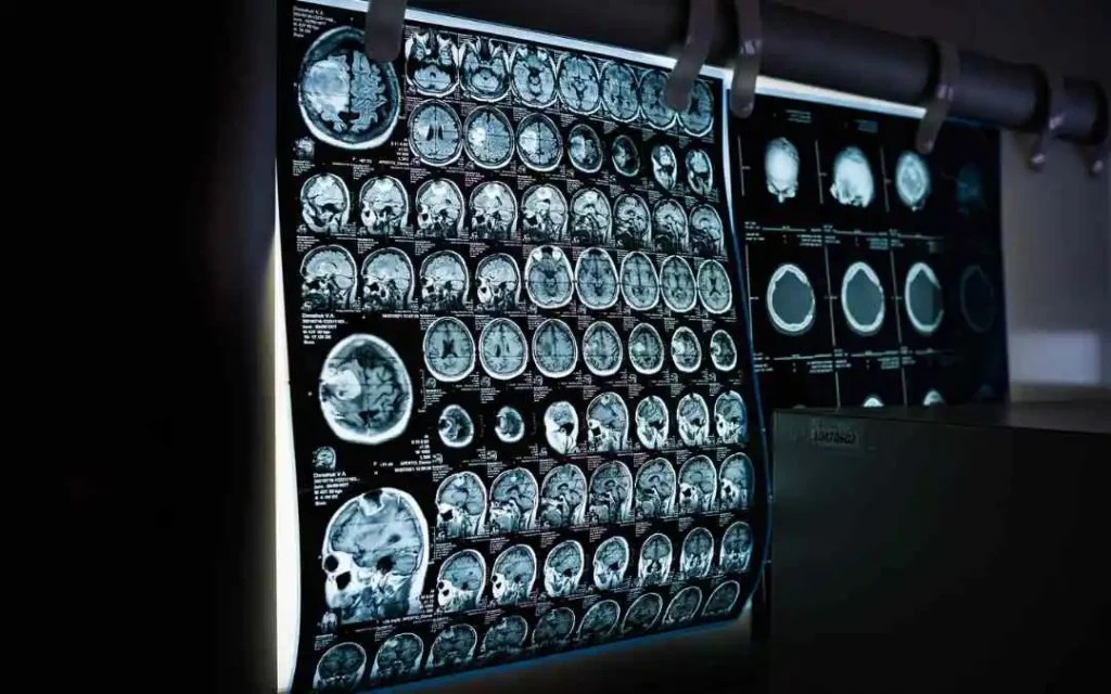 Types of Xray Xray Near Me