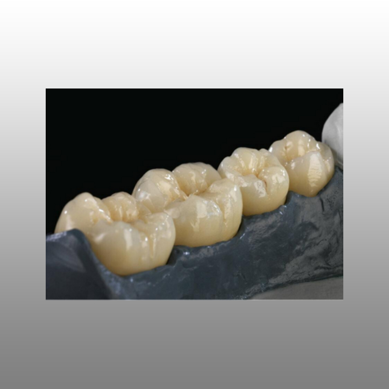 DENTSPLY CERCON ® XT ML DG Digital Dental Lab