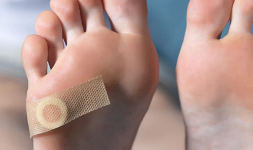 Expert Podiatric Care for Foot Warts When to Consult a Specialist
