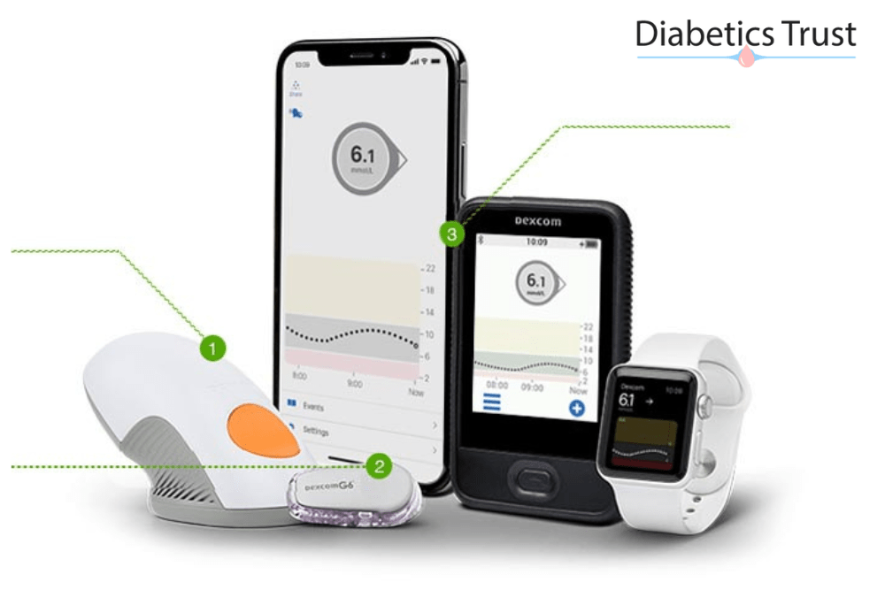 How Long Does a g6 Transmitter Last? Diabetics Trust