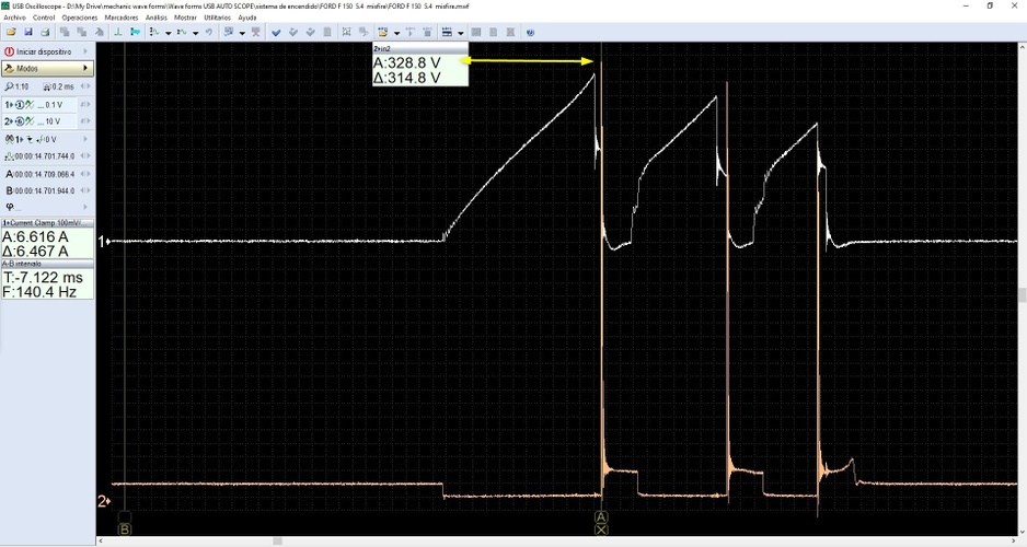14 multi inductive kick voltaje.jpg Bitmap, Image Diagnostic Network