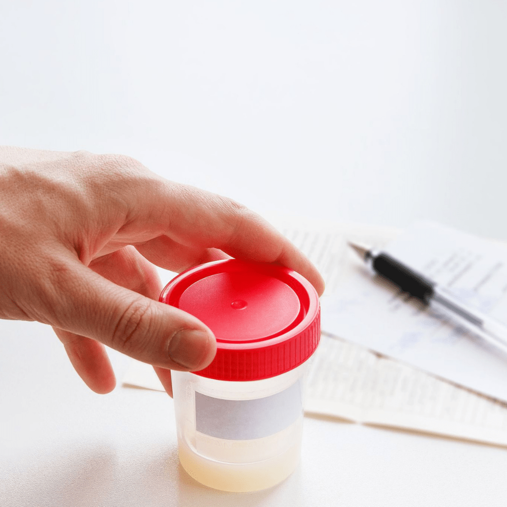 Aspectos relevantes de un espermograma o análisis de semen Diagnostika