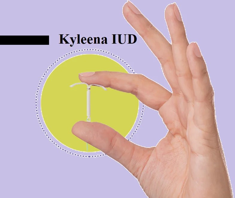 Kyleena And PCOS Assessing PROS And CONS Dibesity