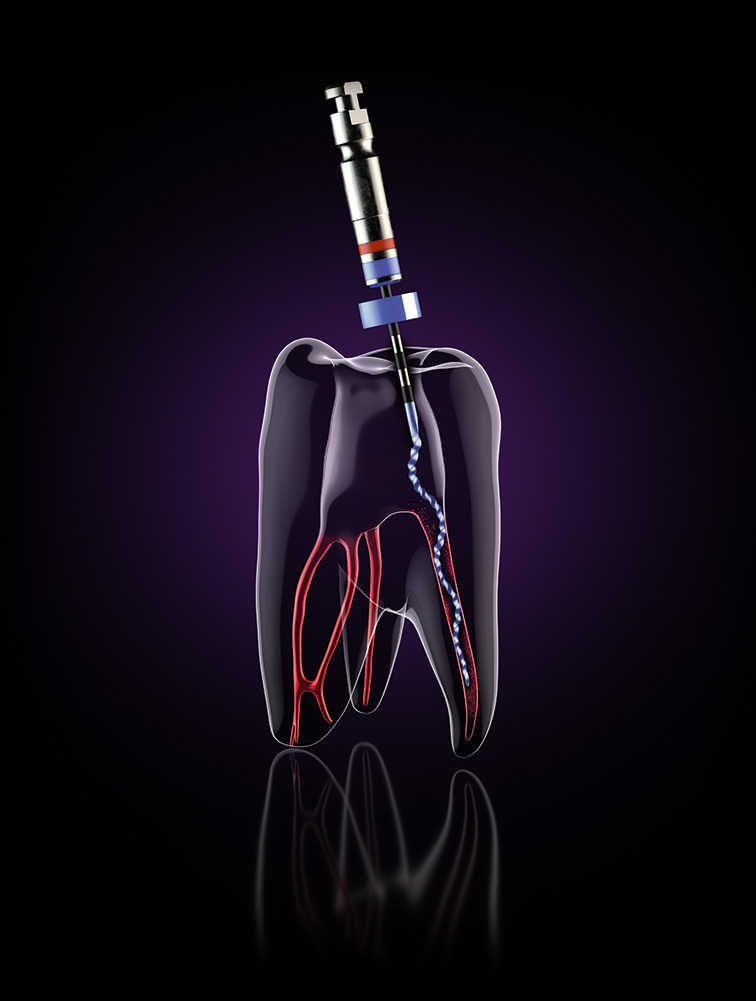 XPendo Shaper XPendo Solutions