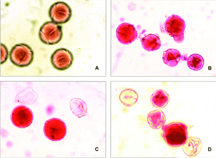acetocarmine stain alternatives Differbetween
