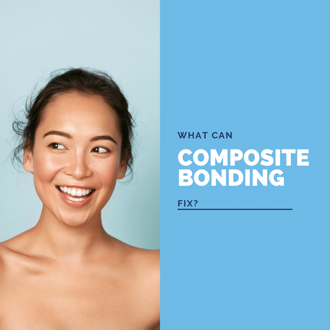 What Can Composite Bonding Fix? Digital Denture + Implants Los Angeles, CA