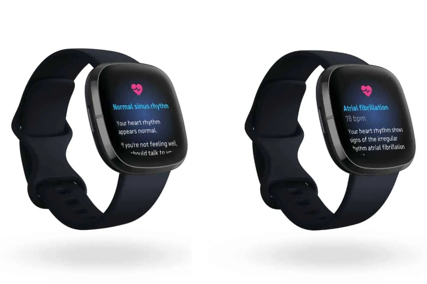 FITBIT SENSE The ECG app is finally live! Digital Health Central