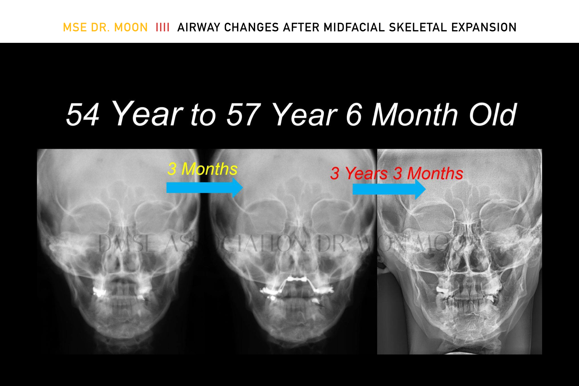 Planning & Design of Digital MSE Course - Digital Marpe