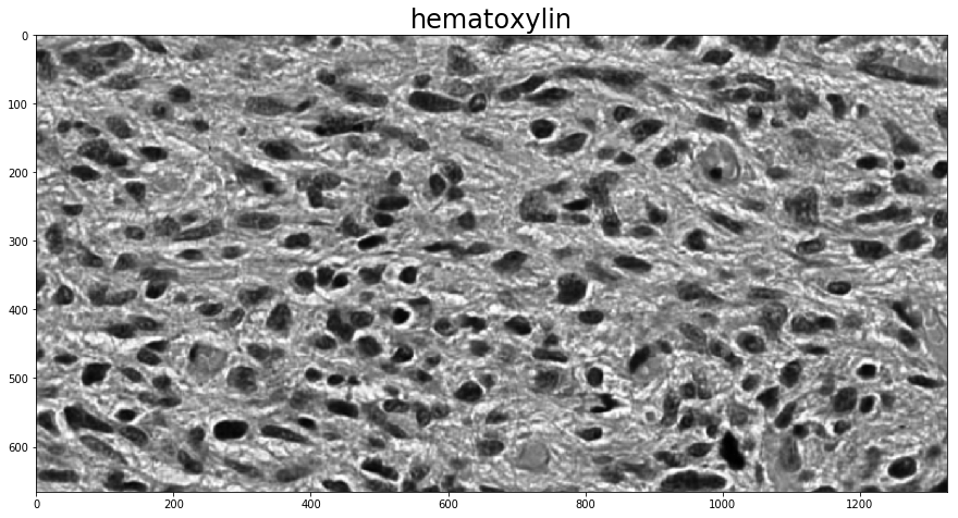 Color Deconvolution — HistomicsTK 0.1.0 documentation