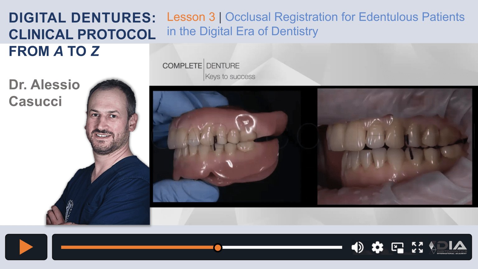 Occlusal Registration for Edentulous Patients in the Digital Era of