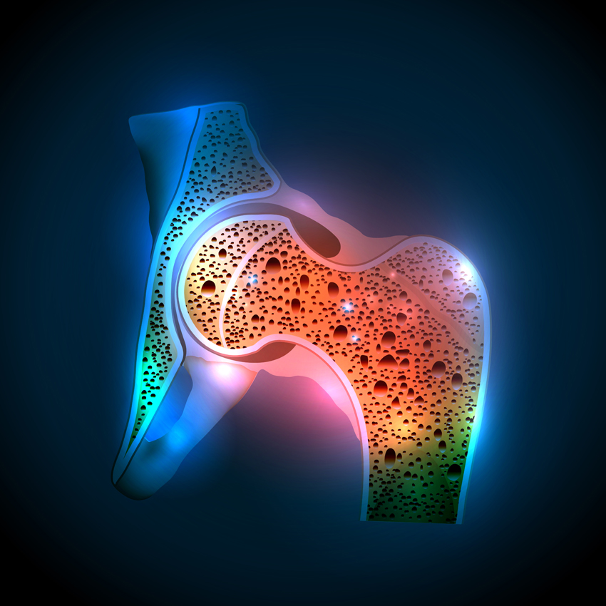 Bone Disease & Osteoporosis Archives Discovery Fine