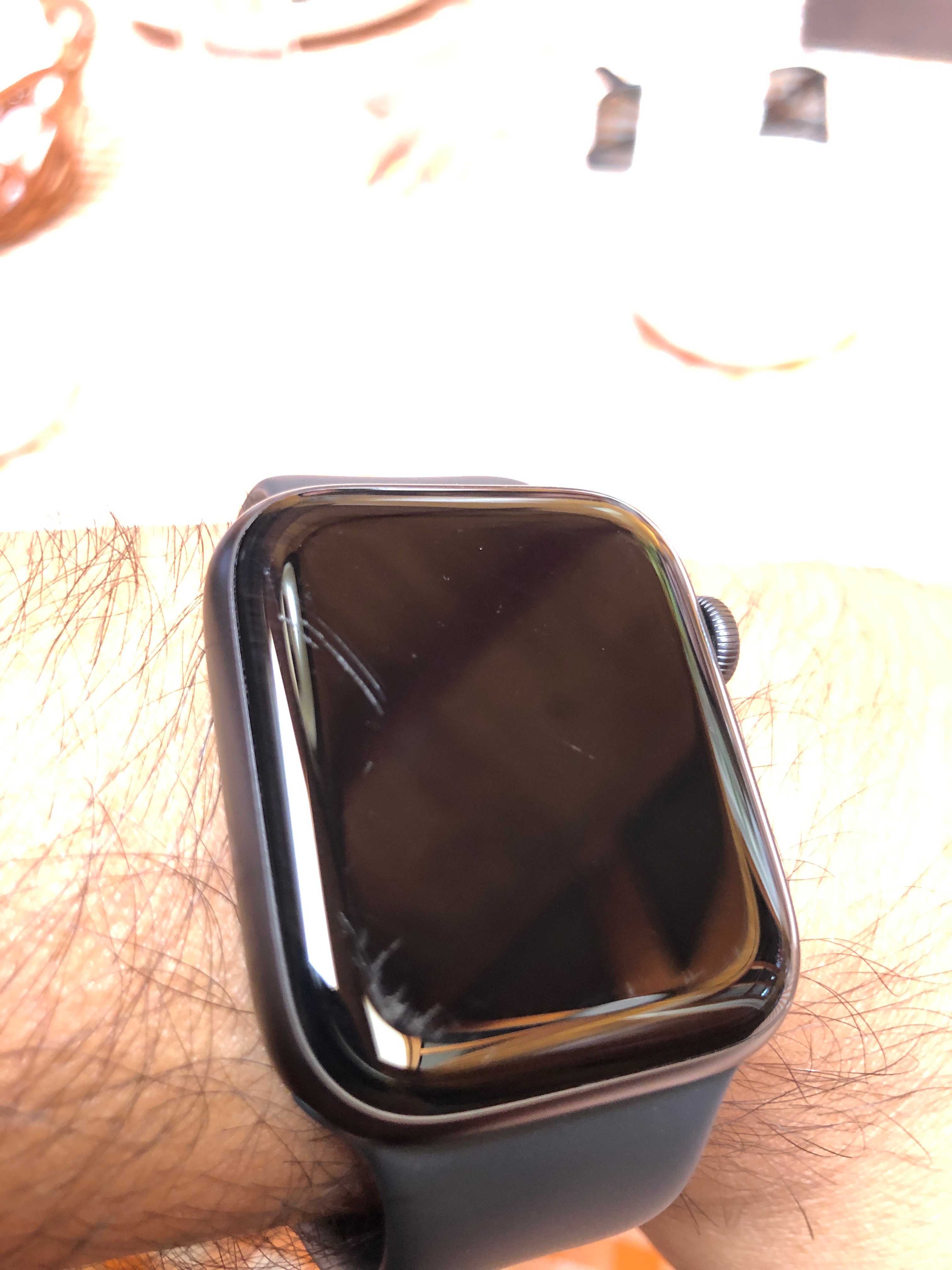 Scratched watch face Apple Community