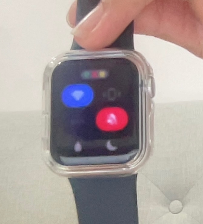 My Apple Watch SE recently started having… Apple Community