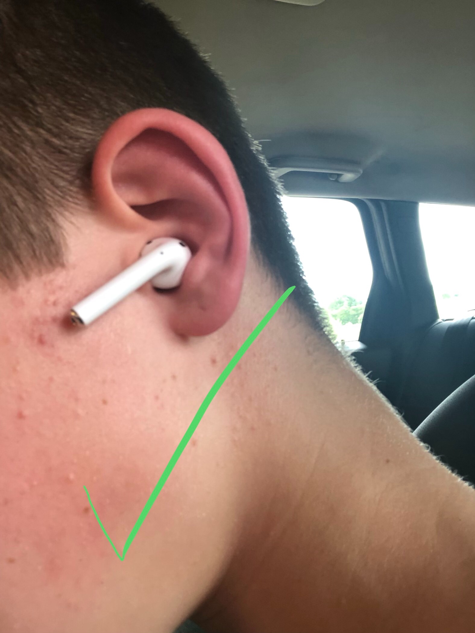 My left airpod fits, but is a bit strange… Apple Community