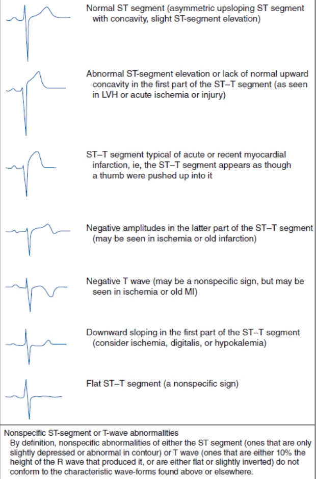 ECG shows upside down on Apple Watch Apple Community