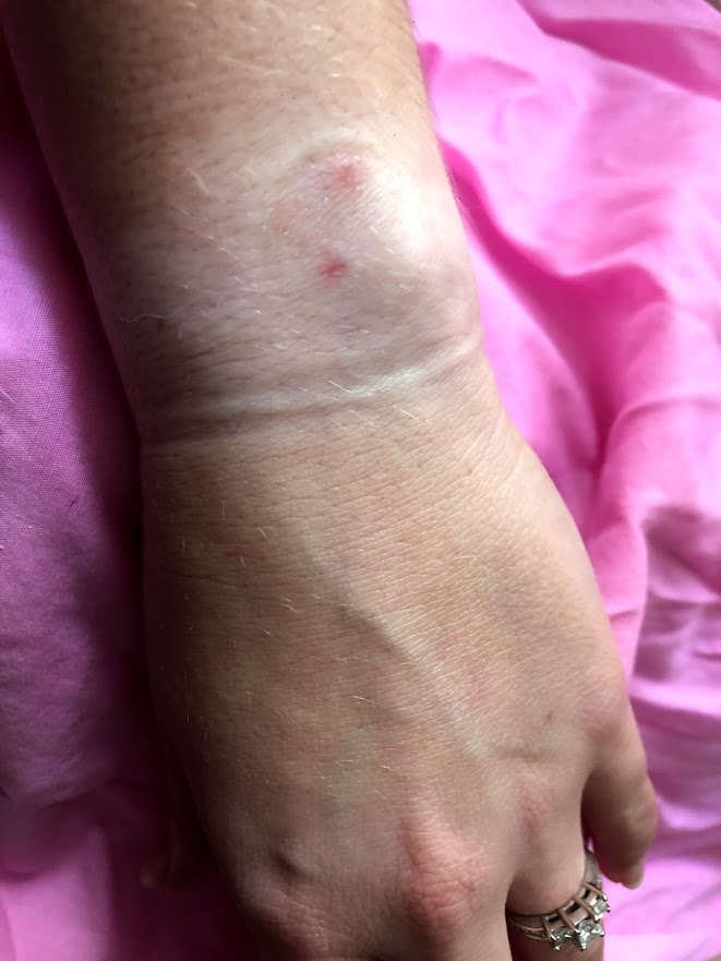 Watch electric shock - Apple Community