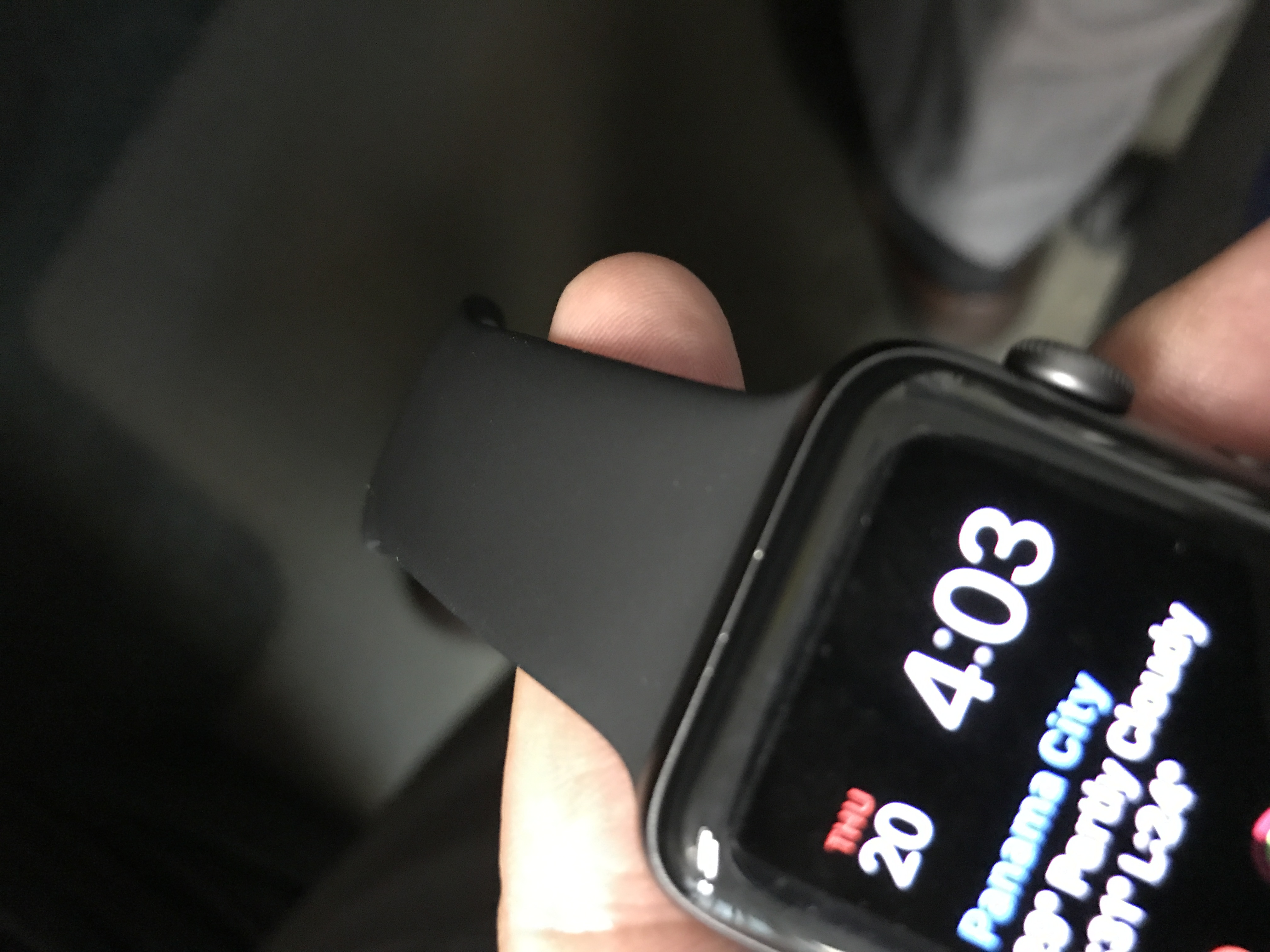 Apple Watch 2 paint peeling!!!! Apple Community