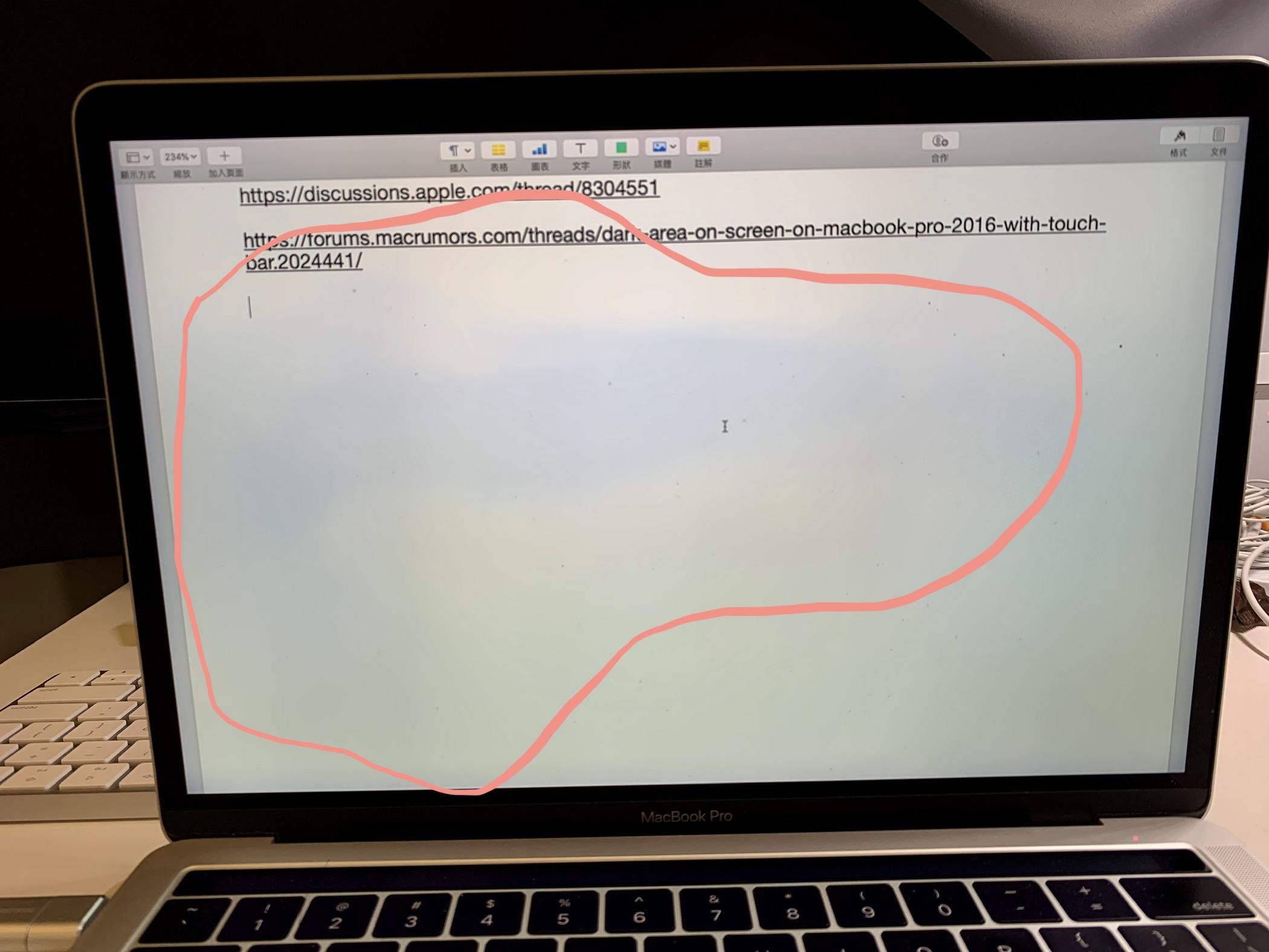 Bluish spots on my MacBook Pro 13" screen… Apple Community