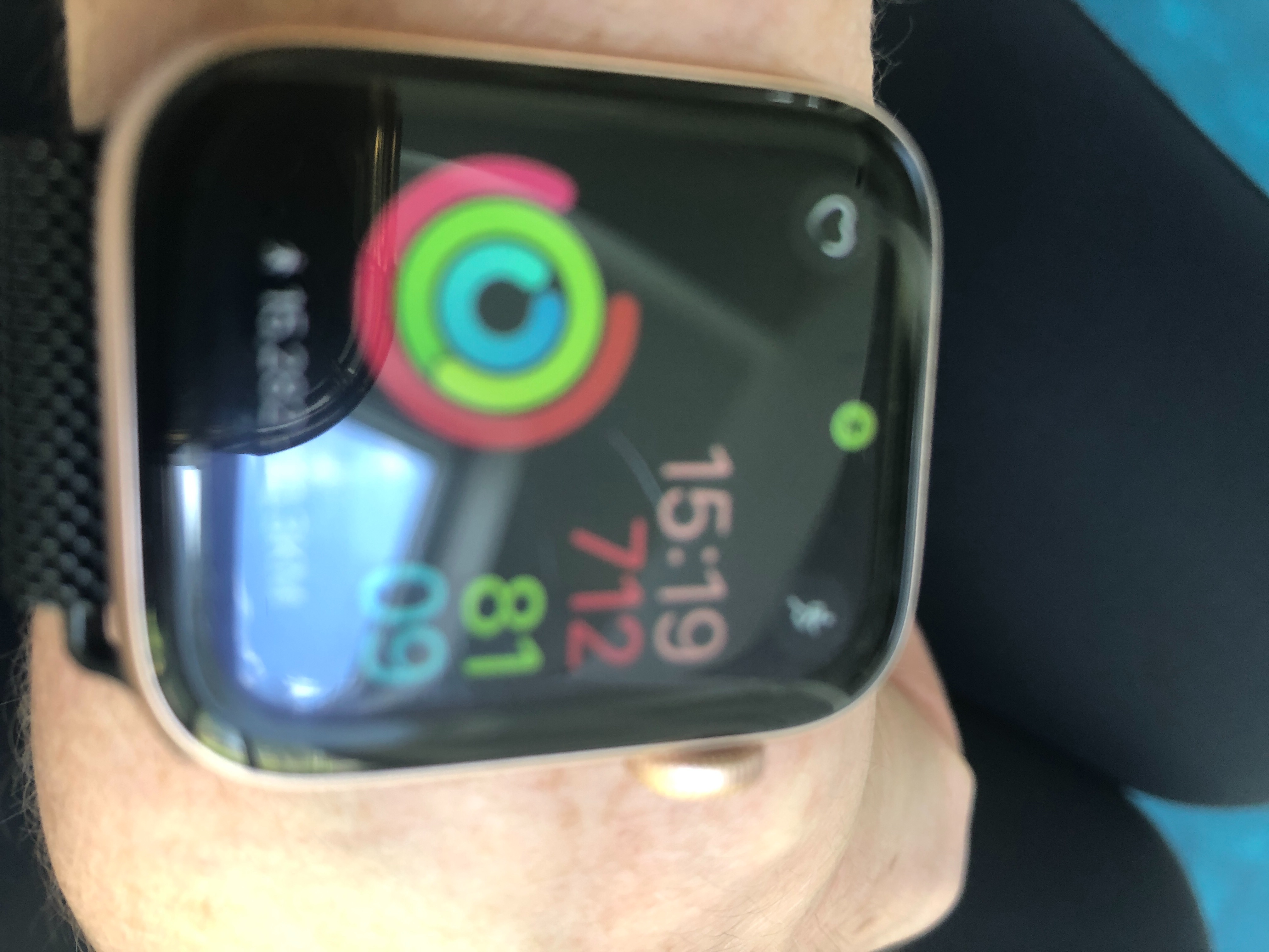 Scratched face on series 6 watch Apple Community