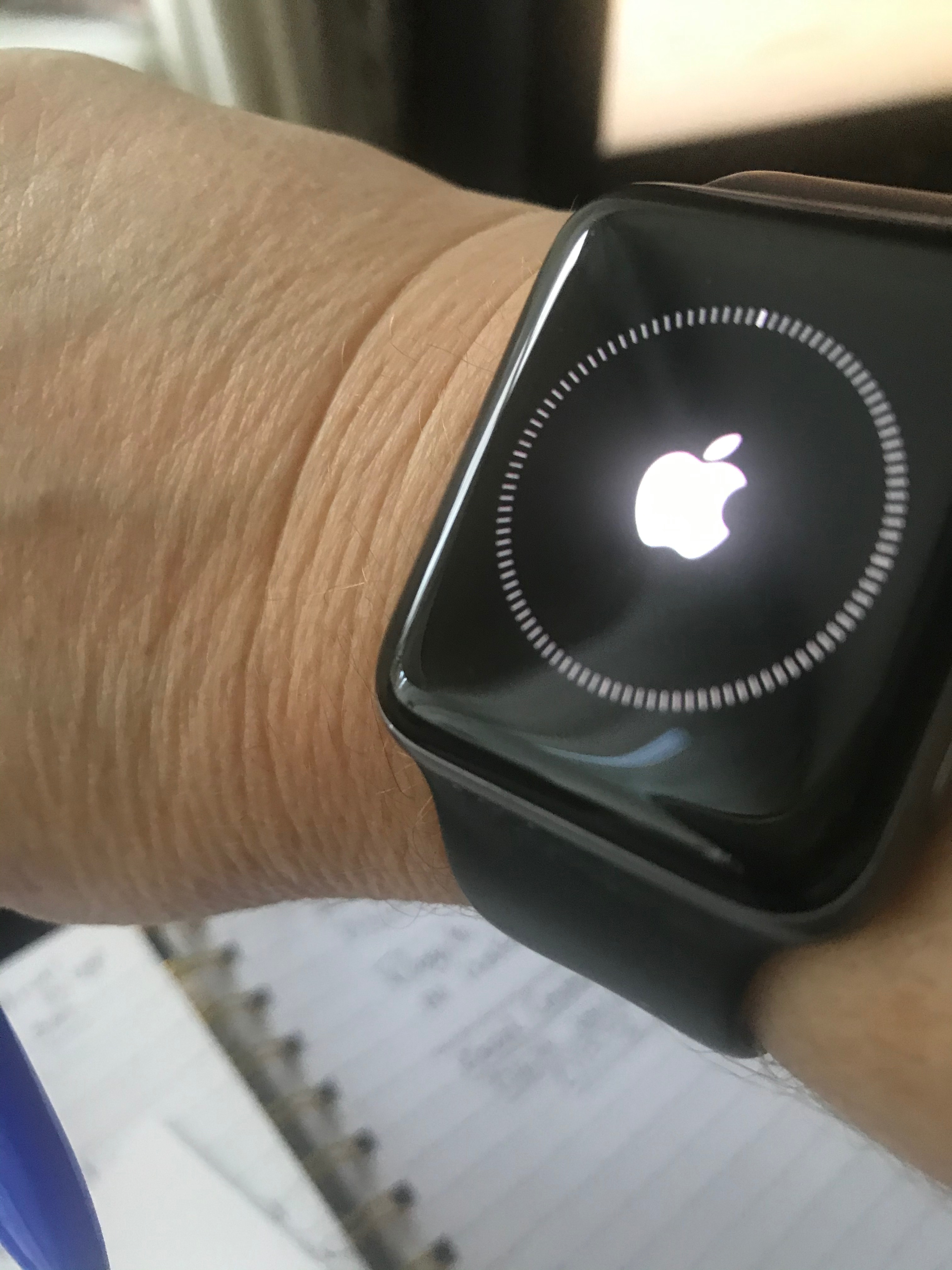 My Apple Watch is suddenly displaying a r… Apple Community