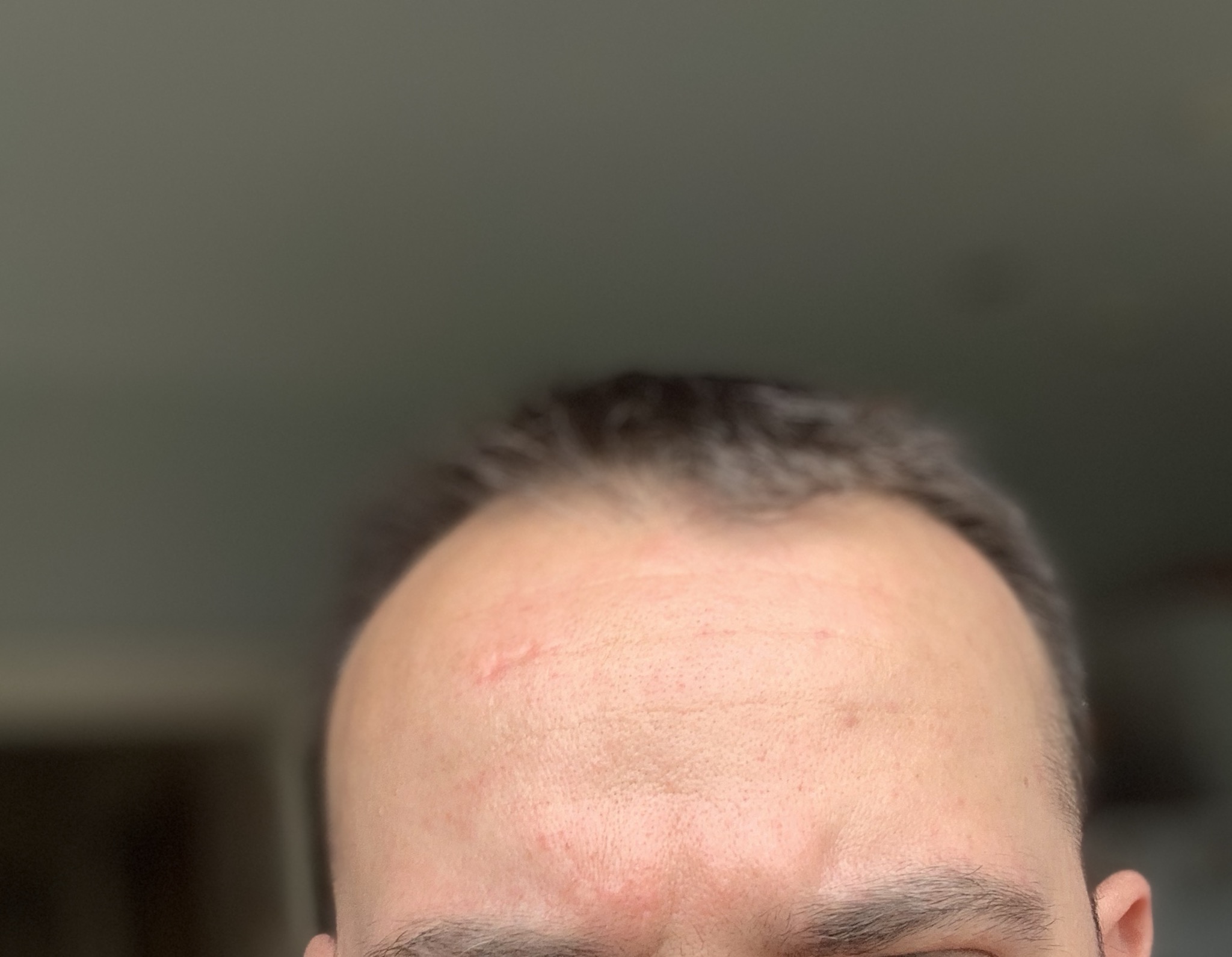 iPhone XR portrait mode issuefront camer… Apple Community