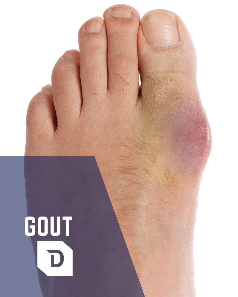 Gout District Foot & Ankle