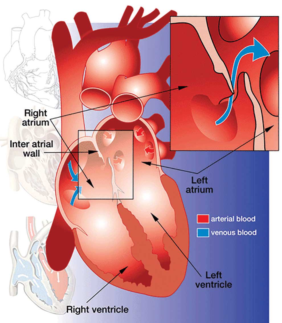 Understanding PFO DIVER magazine