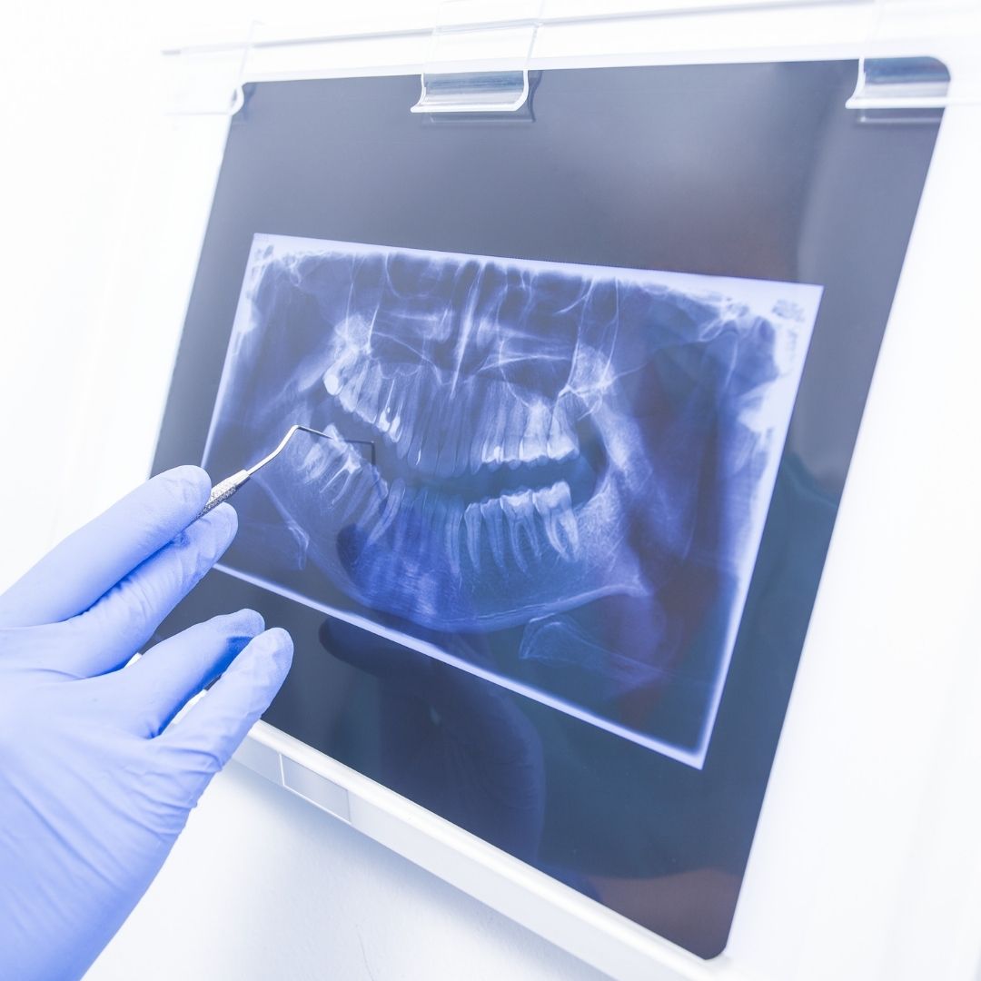 Preventive Dental Care and Cleaning Services in Idaho Falls