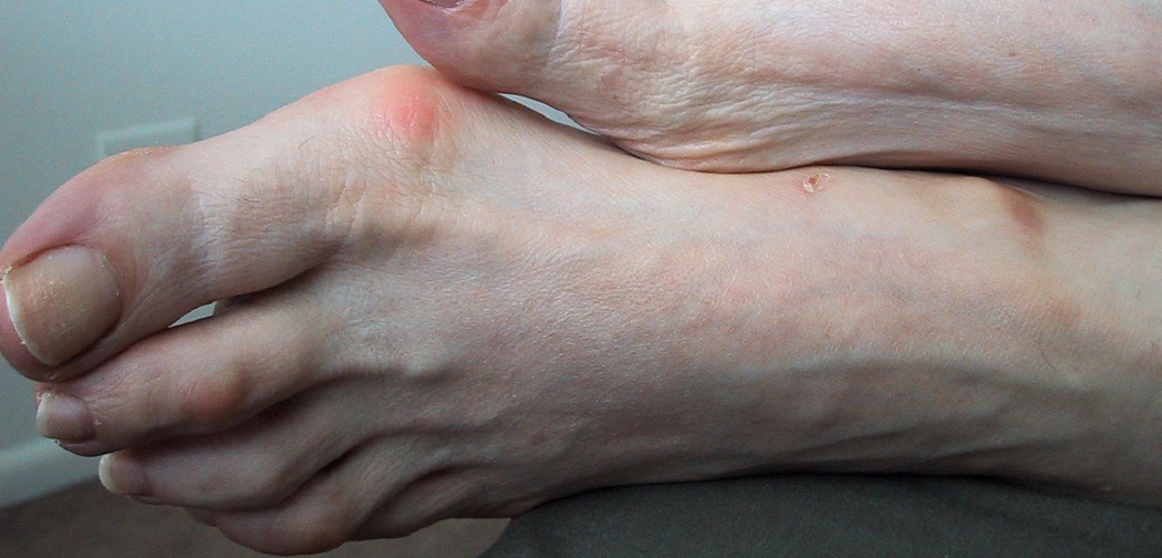 How to Fix Ugly Toes 6 Steps Best Directions (2024)