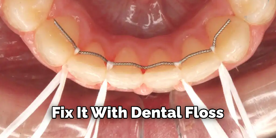 How to Fix a Broken Retainer Wire | 8 Best Ways (2024)