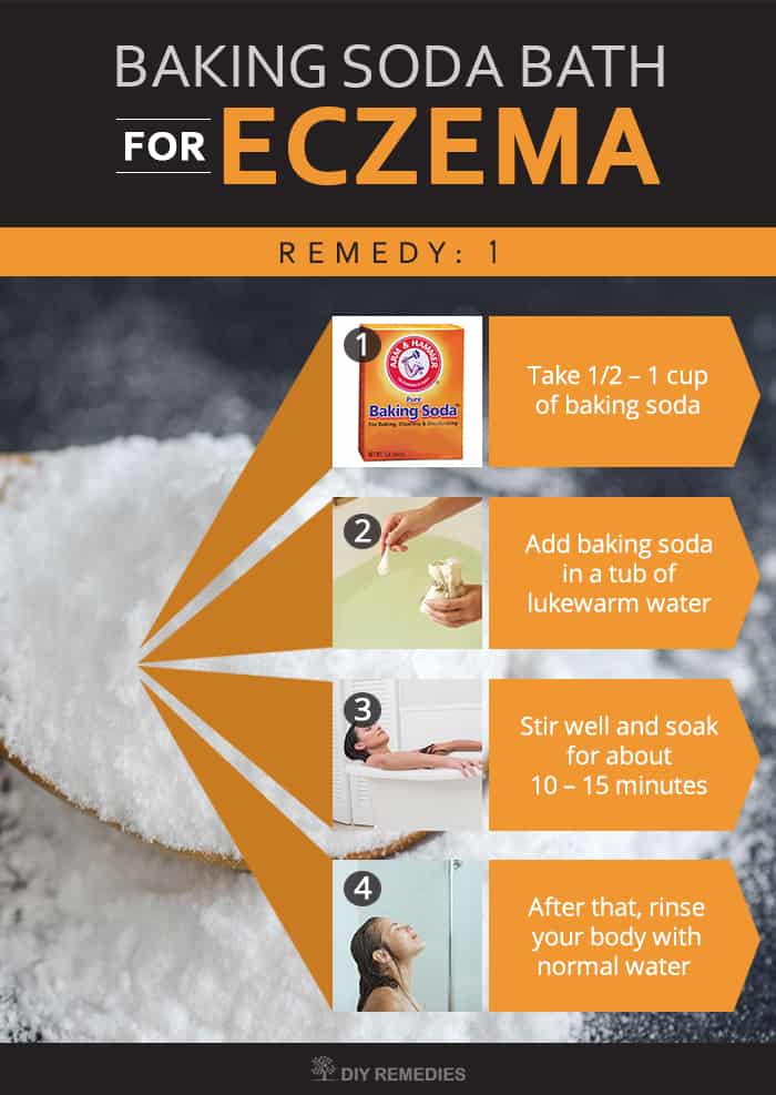 How to Soothe Eczema with Baking Soda