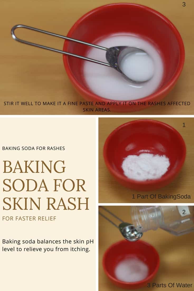 How to use Baking Soda for Rashes