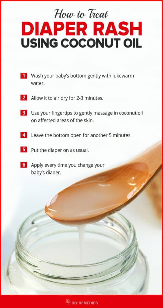 Incredible Diaper Rash Treatment Ideas