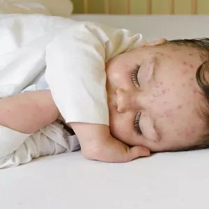 Krentenbaard Bij Je Baby