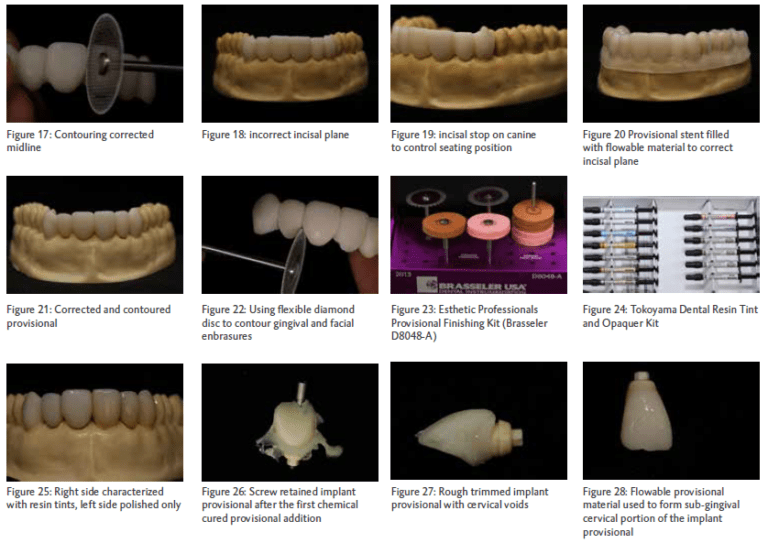 Techniques for Optimizing Provisional Restorations DMG America