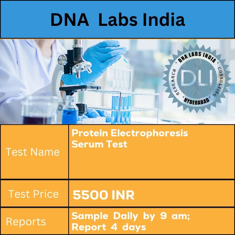 Protein Electrophoresis Serum Test Cost 5500 INR in India
