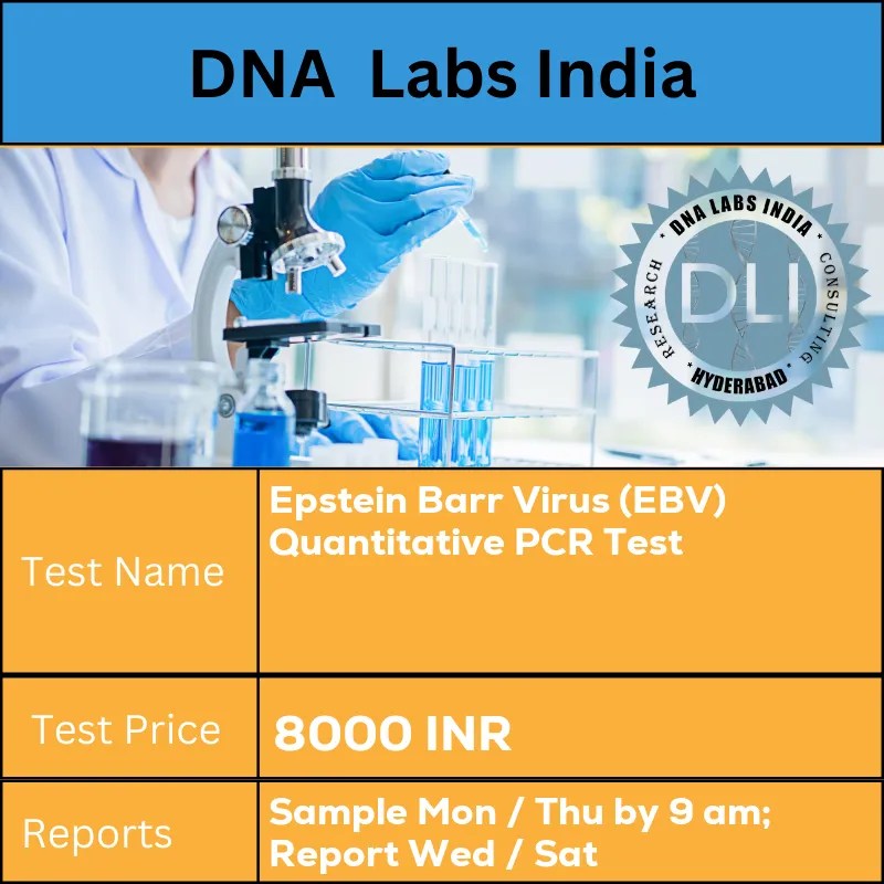 Epstein Barr Virus (EBV) Quantitative PCR Test Cost 8000 INR in India